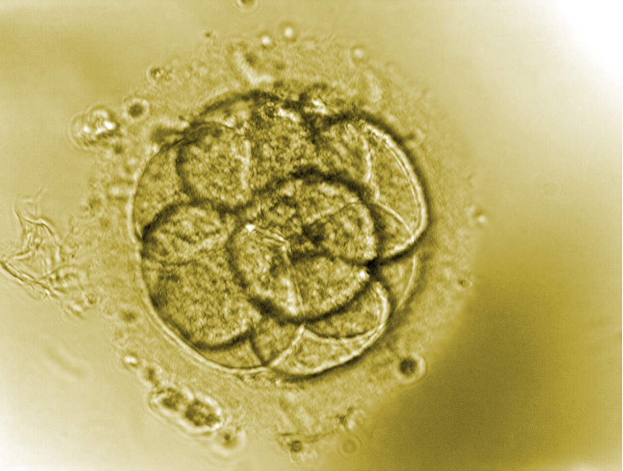 Embryon au stade 8 cellules (3 jours)